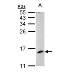 MP1 antibody from Signalway Antibody (22385) - Antibodies.com