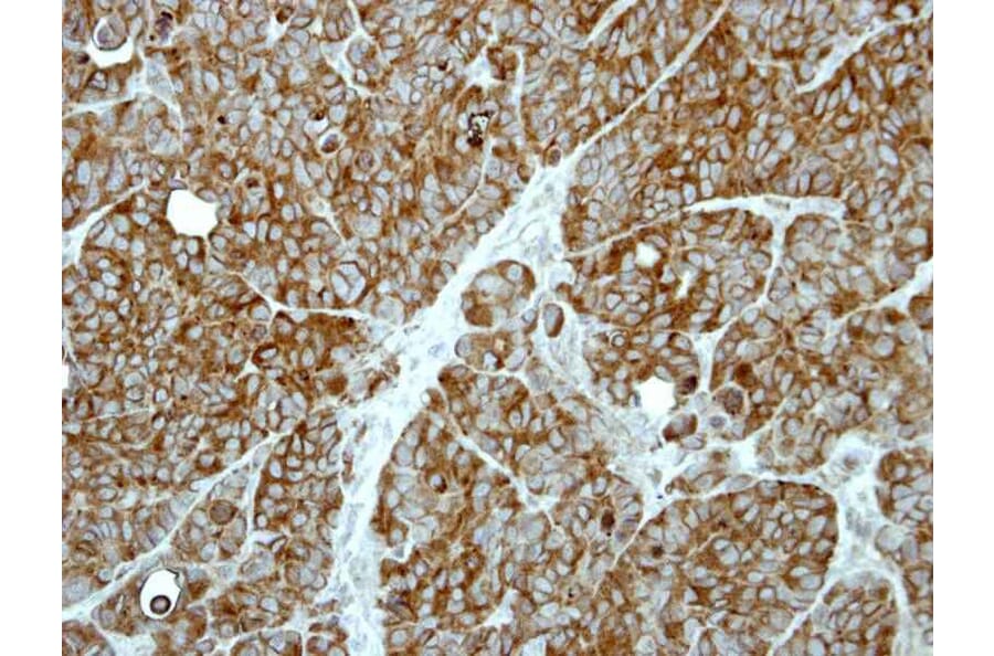 Immunohistochemistry - MP1 antibody from Signalway Antibody (22385) - Antibodies.com