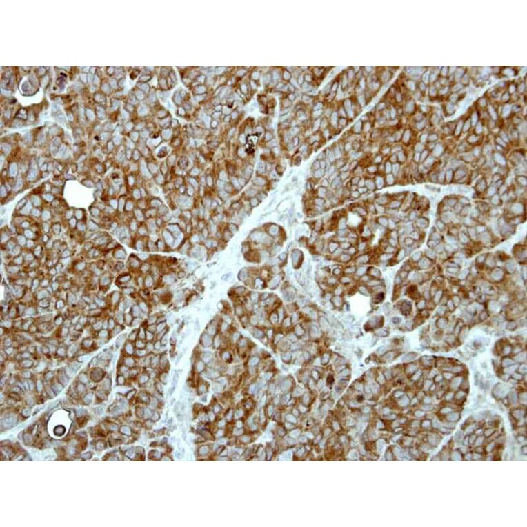 Immunohistochemistry - MP1 antibody from Signalway Antibody (22385) - Antibodies.com