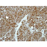 Immunohistochemistry - MP1 antibody from Signalway Antibody (22385) - Antibodies.com