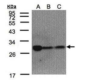 ClpP antibody from Signalway Antibody (22450) - Antibodies.com