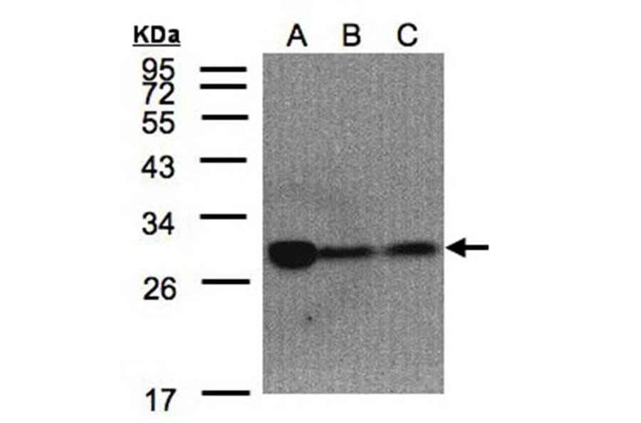 ClpP antibody from Signalway Antibody (22450) - Antibodies.com