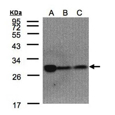 ClpP antibody from Signalway Antibody (22450) - Antibodies.com