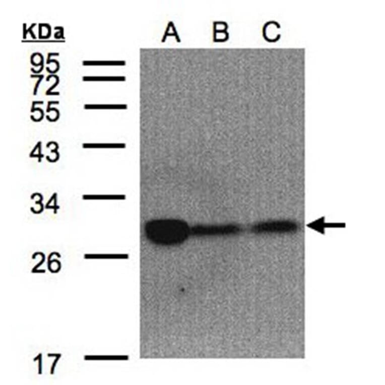 ClpP antibody from Signalway Antibody (22450) - Antibodies.com