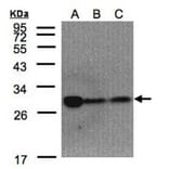 ClpP antibody from Signalway Antibody (22450) - Antibodies.com