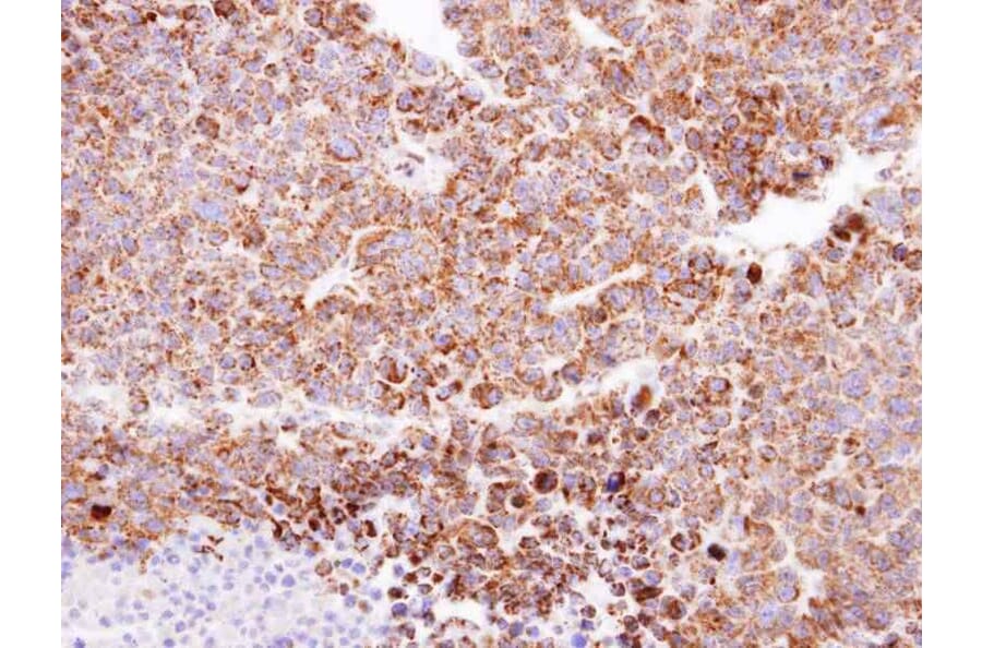 Immunohistochemistry - ClpP antibody from Signalway Antibody (22450) - Antibodies.com