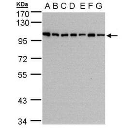 HPS3 antibody from Signalway Antibody (22451) - Antibodies.com