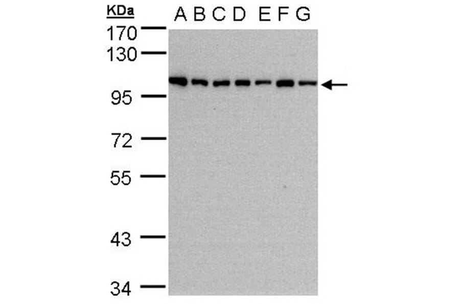 HPS3 antibody from Signalway Antibody (22451) - Antibodies.com