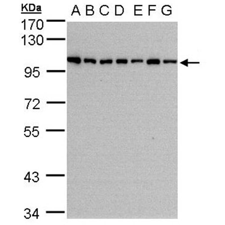 HPS3 antibody from Signalway Antibody (22451) - Antibodies.com