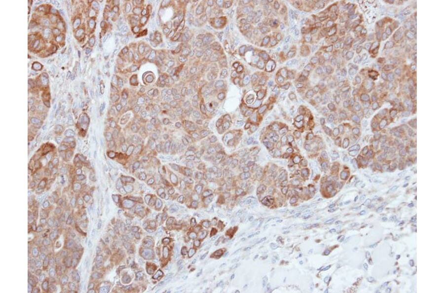 Immunohistochemistry - HPS3 antibody from Signalway Antibody (22451) - Antibodies.com