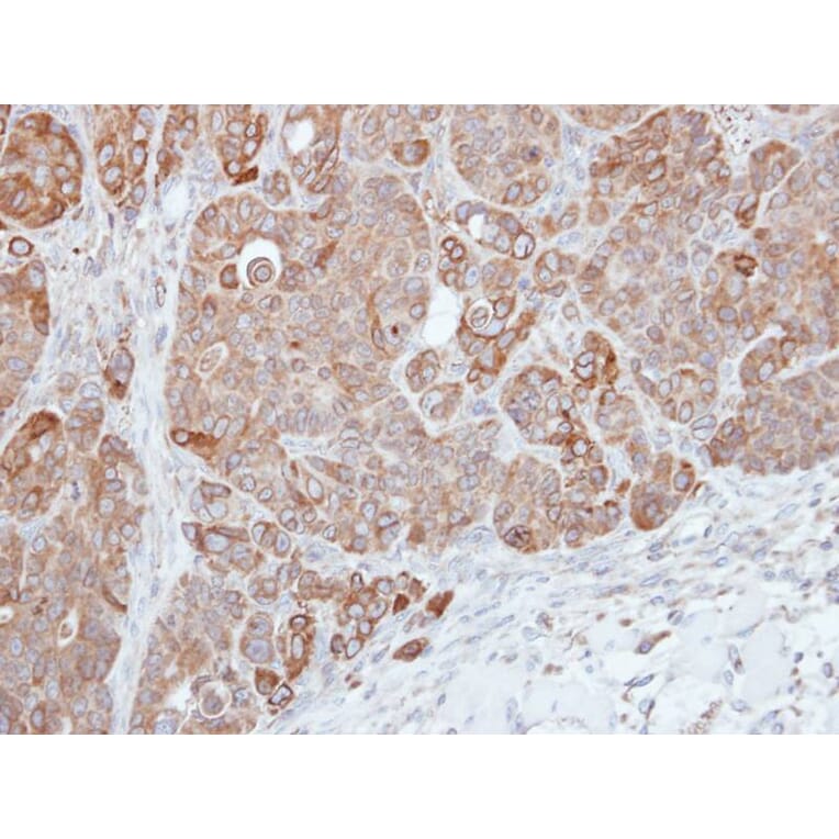 Immunohistochemistry - HPS3 antibody from Signalway Antibody (22451) - Antibodies.com