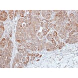 Immunohistochemistry - HPS3 antibody from Signalway Antibody (22451) - Antibodies.com