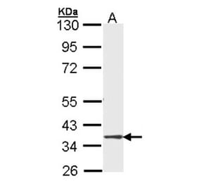 DMC1 antibody from Signalway Antibody (22485) - Antibodies.com