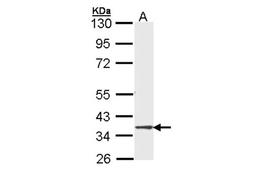 DMC1 antibody from Signalway Antibody (22485) - Antibodies.com