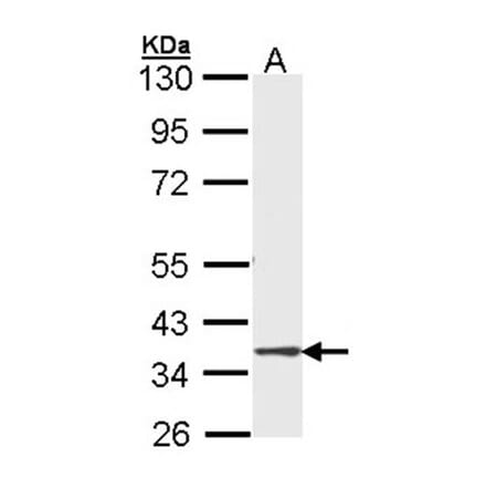 DMC1 antibody from Signalway Antibody (22485) - Antibodies.com
