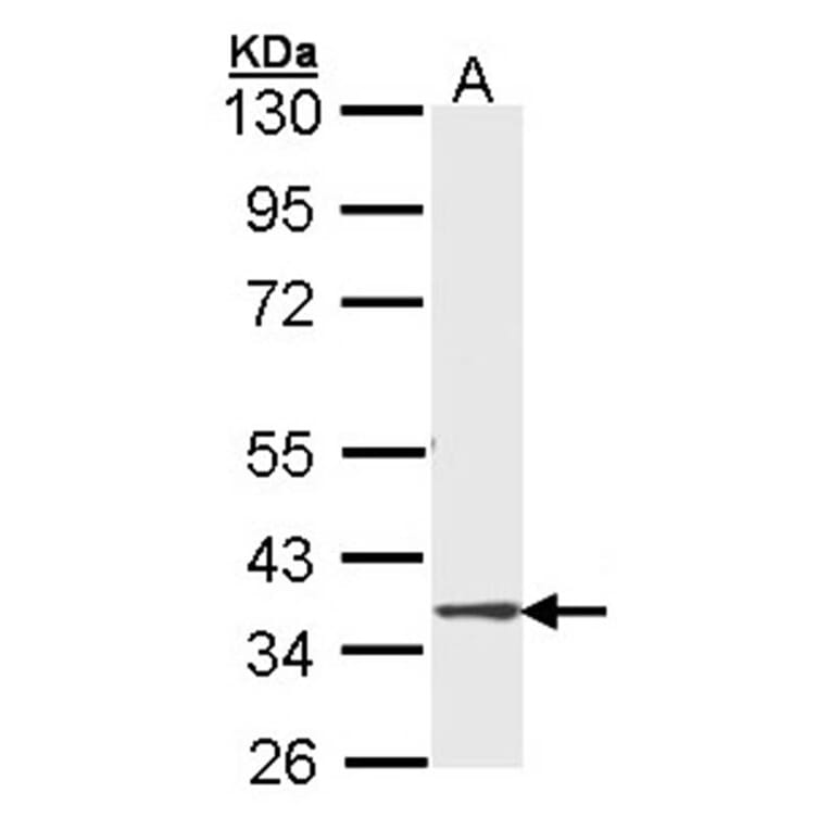 DMC1 antibody from Signalway Antibody (22485) - Antibodies.com