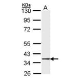 DMC1 antibody from Signalway Antibody (22485) - Antibodies.com