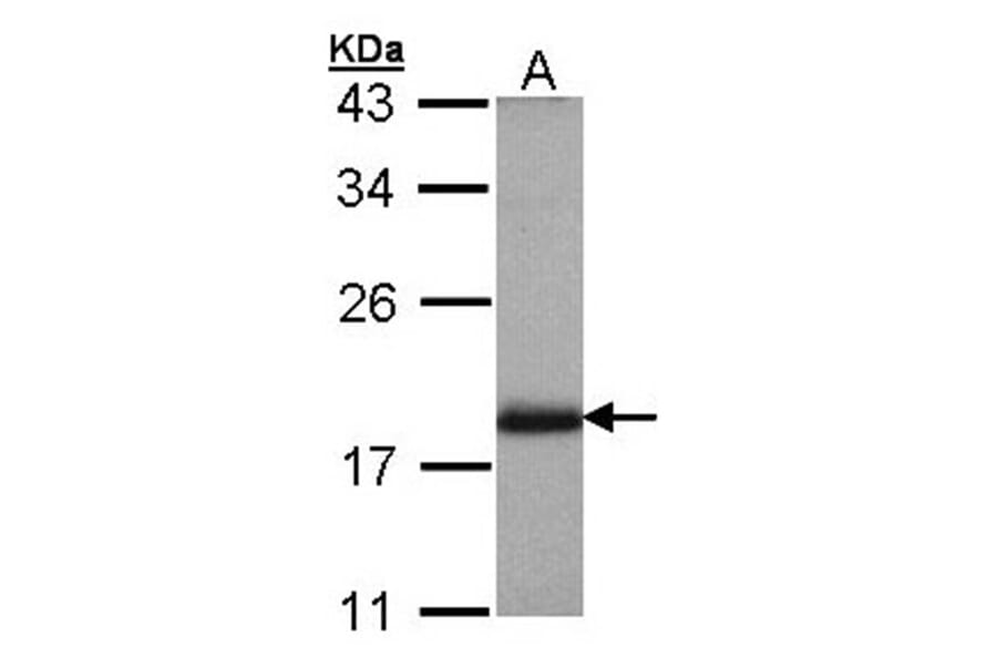 ARL4 antibody from Signalway Antibody (22527) - Antibodies.com