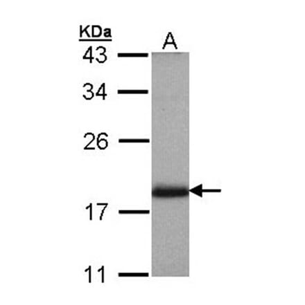ARL4 antibody from Signalway Antibody (22527) - Antibodies.com