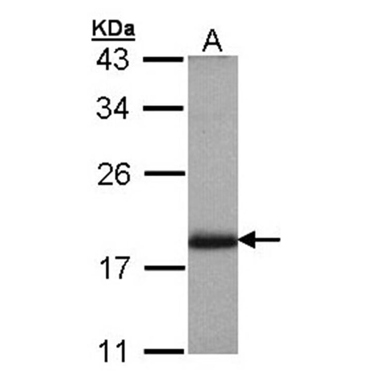 ARL4 antibody from Signalway Antibody (22527) - Antibodies.com