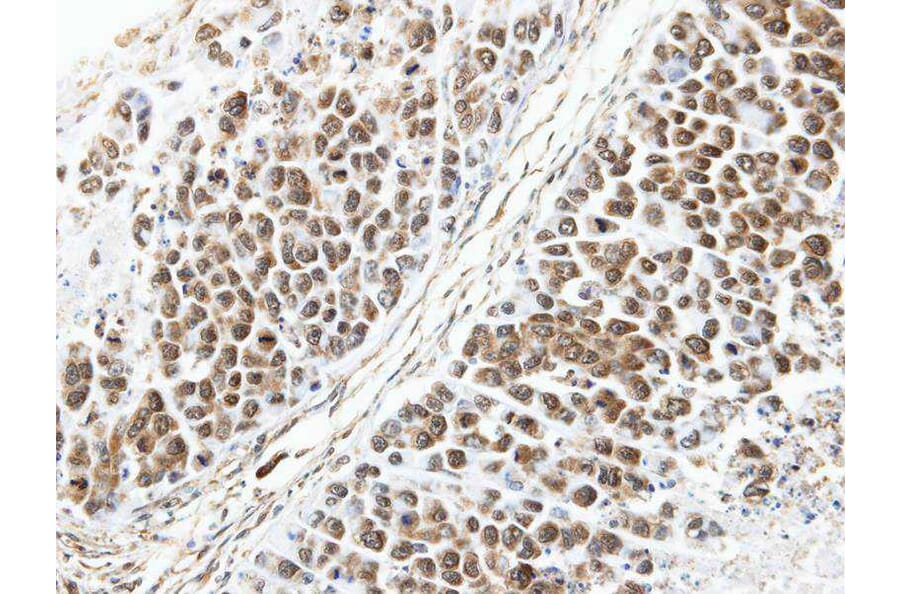 Immunohistochemistry - ARL4 antibody from Signalway Antibody (22527) - Antibodies.com
