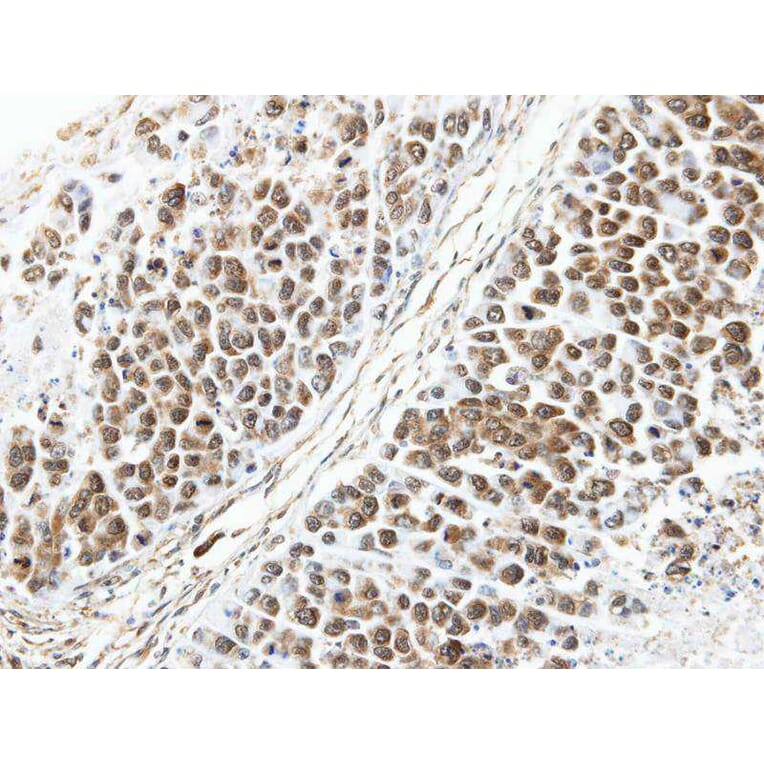 Immunohistochemistry - ARL4 antibody from Signalway Antibody (22527) - Antibodies.com