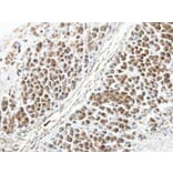 Immunohistochemistry - ARL4 antibody from Signalway Antibody (22527) - Antibodies.com