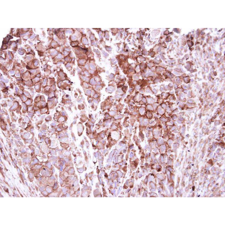 Immunohistochemistry - ZO-1 antibody from Signalway Antibody (22572) - Antibodies.com