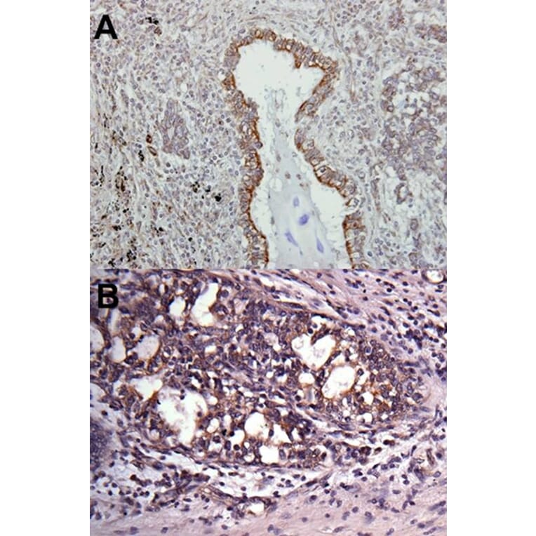 Immunohistochemistry - VAPA antibody from Signalway Antibody (22585) - Antibodies.com