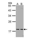 PCNP antibody from Signalway Antibody (22600) - Antibodies.com