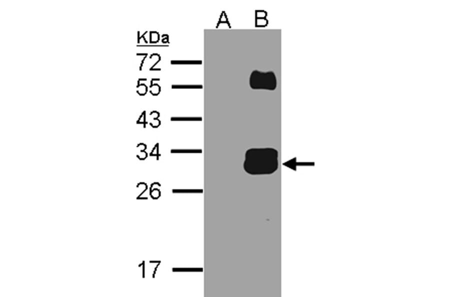 Western blot - KLK7 antibody from Signalway Antibody (22619) - Antibodies.com