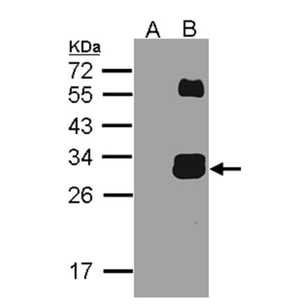 Western blot - KLK7 antibody from Signalway Antibody (22619) - Antibodies.com