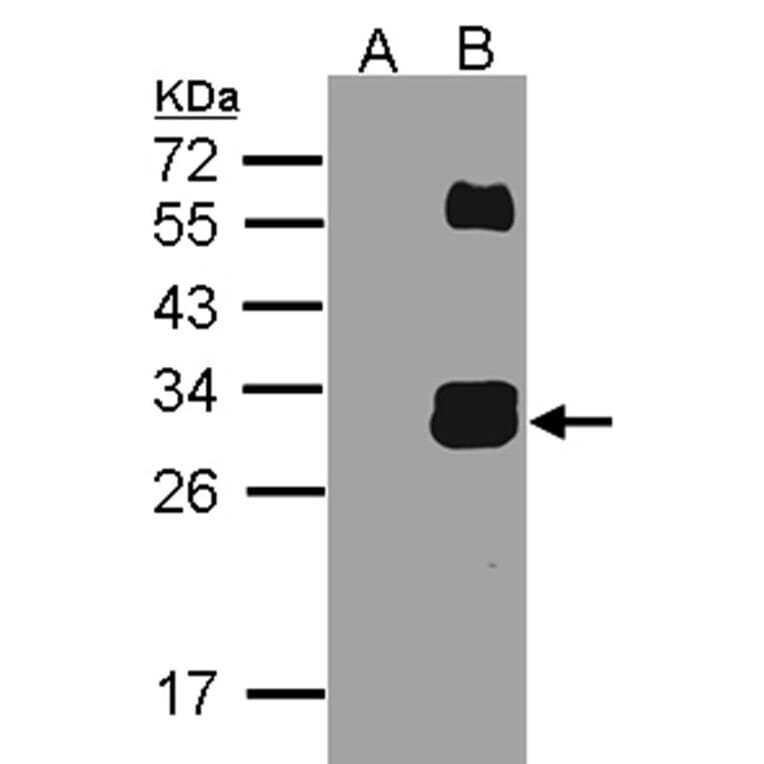 Western blot - KLK7 antibody from Signalway Antibody (22619) - Antibodies.com