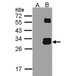 Western blot - KLK7 antibody from Signalway Antibody (22619) - Antibodies.com