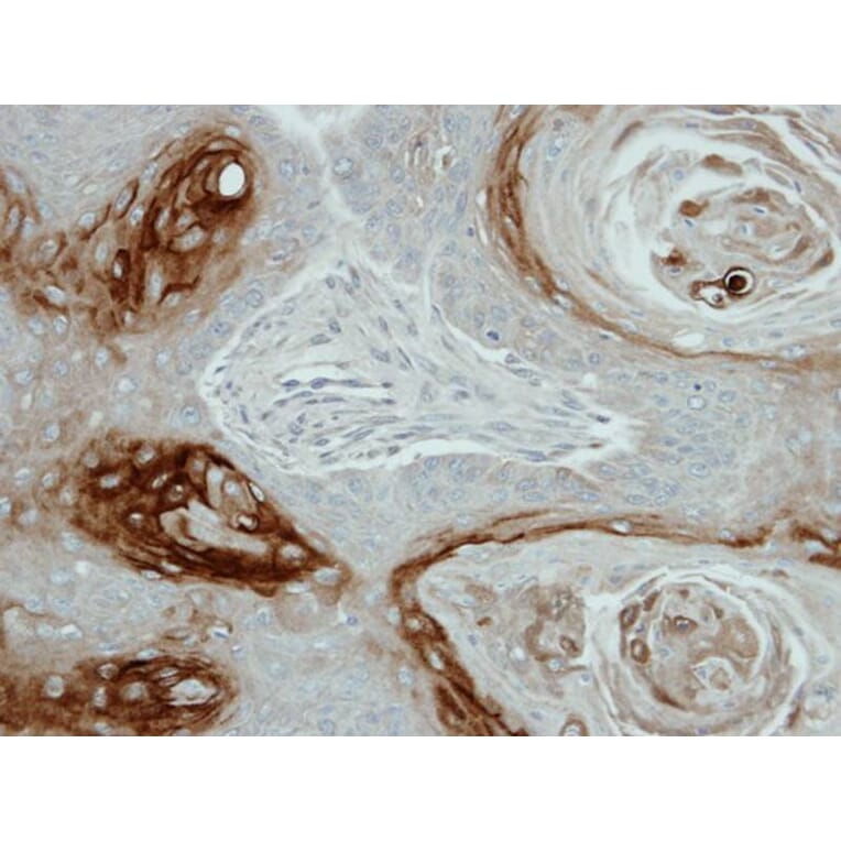 Immunohistochemistry - KLK7 antibody from Signalway Antibody (22619) - Antibodies.com