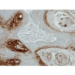 Immunohistochemistry - KLK7 antibody from Signalway Antibody (22619) - Antibodies.com