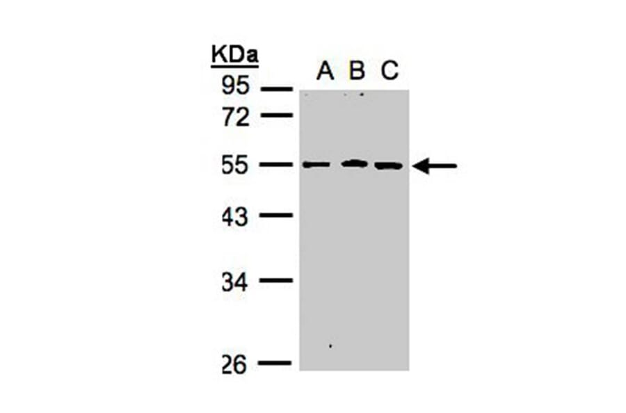RGMB antibody from Signalway Antibody (22623) - Antibodies.com
