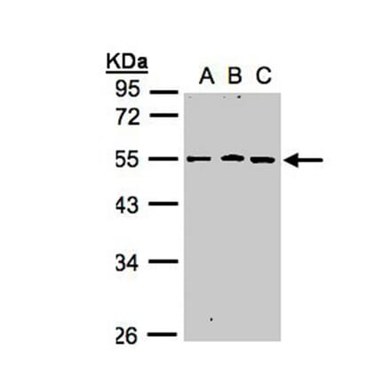 RGMB antibody from Signalway Antibody (22623) - Antibodies.com