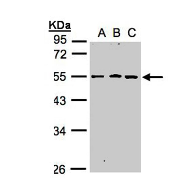 RGMB antibody from Signalway Antibody (22623) - Antibodies.com