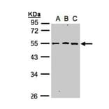 RGMB antibody from Signalway Antibody (22623) - Antibodies.com
