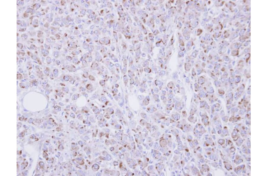 Immunohistochemistry - RGMB antibody from Signalway Antibody (22623) - Antibodies.com