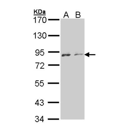 NEK4 antibody from Signalway Antibody (22637) - Antibodies.com