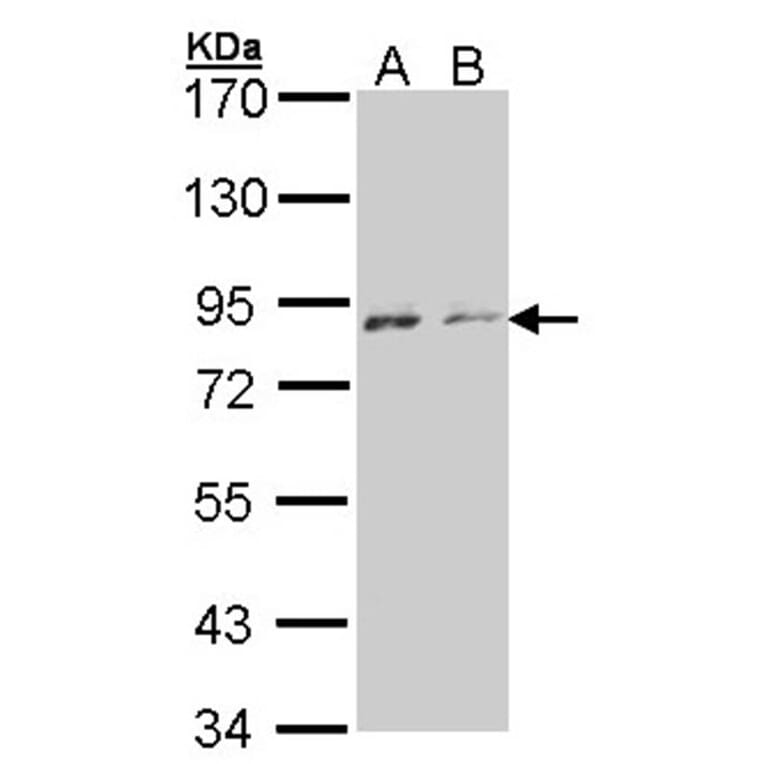 NEK4 antibody from Signalway Antibody (22637) - Antibodies.com