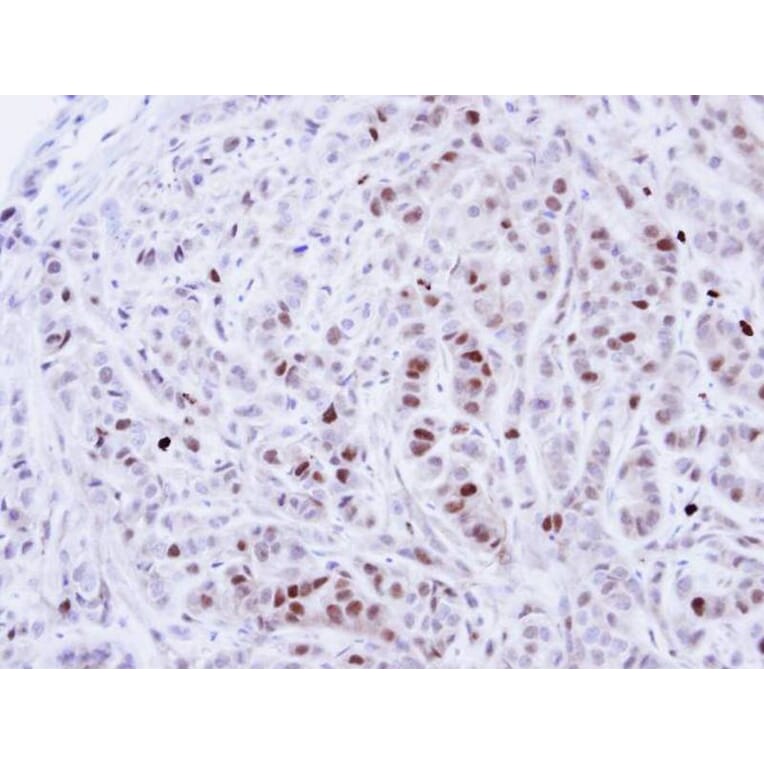 Immunohistochemistry - NEK4 antibody from Signalway Antibody (22637) - Antibodies.com