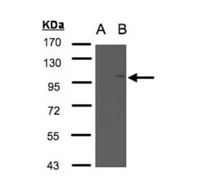Western blot - FAN antibody from Signalway Antibody (22667) - Antibodies.com