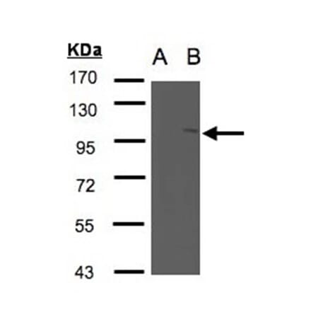 Western blot - FAN antibody from Signalway Antibody (22667) - Antibodies.com