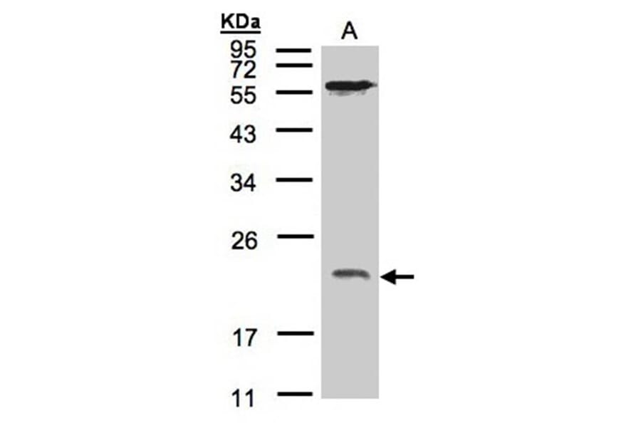 ARF1 antibody from Signalway Antibody (22691) - Antibodies.com
