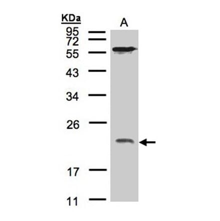 ARF1 antibody from Signalway Antibody (22691) - Antibodies.com