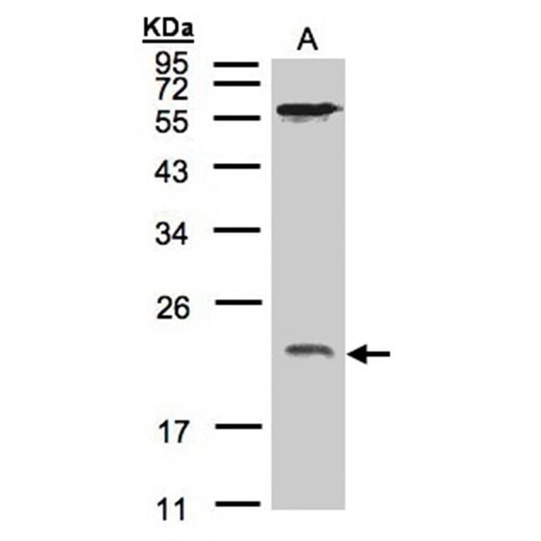 ARF1 antibody from Signalway Antibody (22691) - Antibodies.com