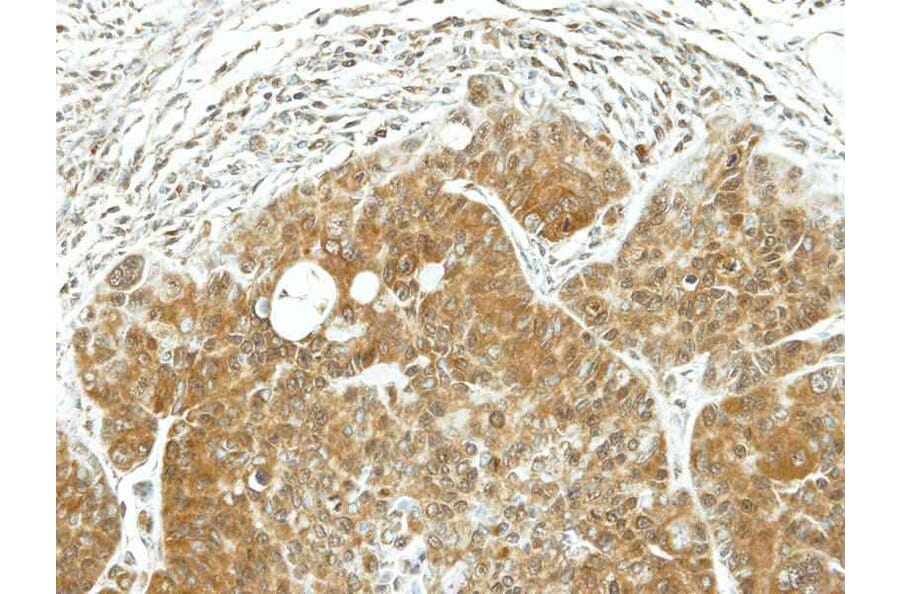 Immunohistochemistry - ARF1 antibody from Signalway Antibody (22691) - Antibodies.com